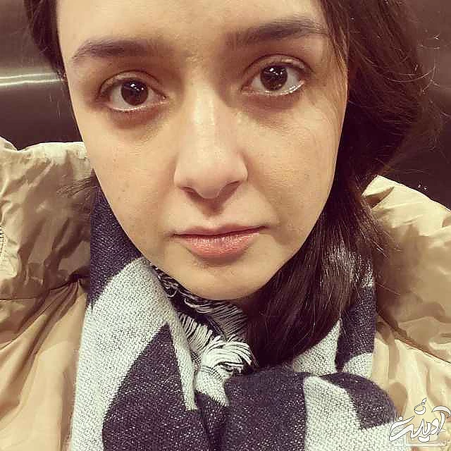 اعتراف ترانه علیدوستی به دماغ چاق خود